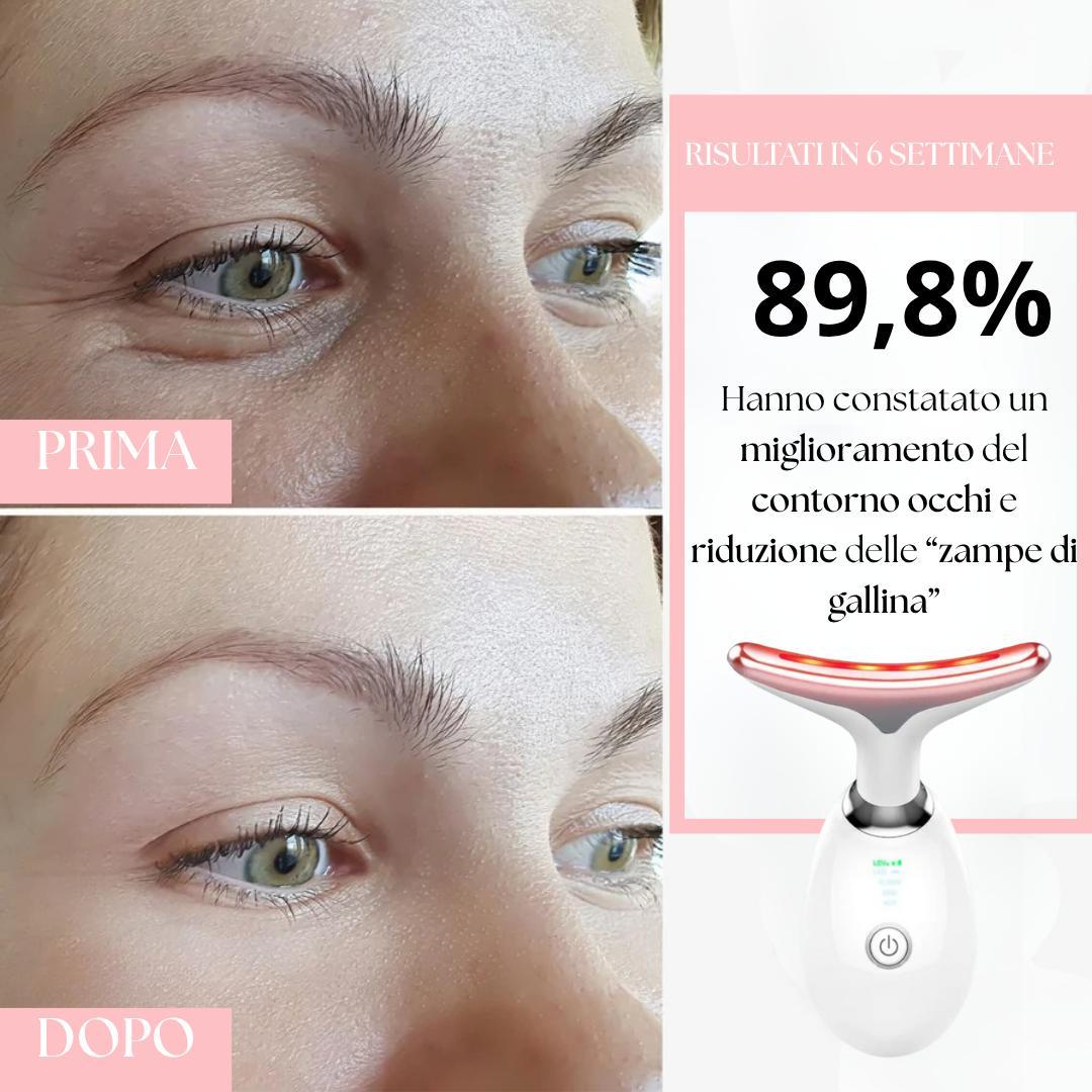 AuraLift - Massaggiatore Viso